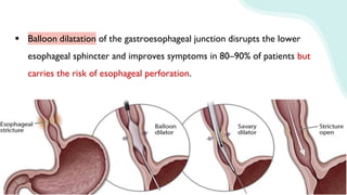  Balloon dilatation of the gastroesophageal junction disrupts the lower
esophageal sphincter and improves symptoms in 80–90% of patients but
carries the risk of esophageal perforation.
 