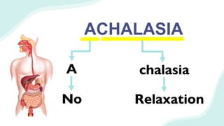 ACHALASIA
A chalasia
No Relaxation
 