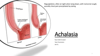 Achalasia
Razan Adib Al-sawadi
Topic Presentation
IM 471
1
Regurgitation, often at night when lying down, with nocturnal cough;
possibly chest pain precipitated by eating
 