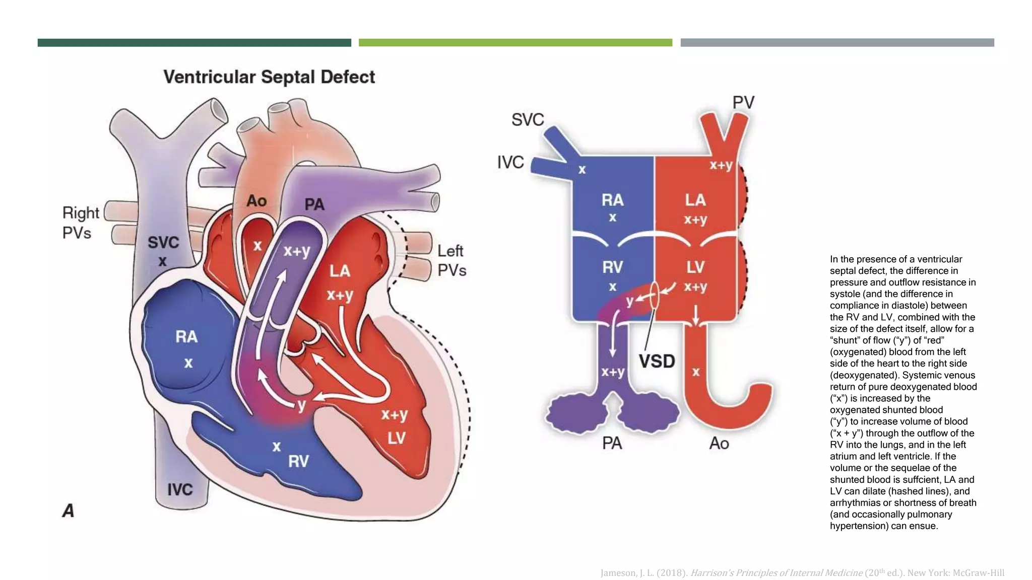 Acyanotic congenital heart disease | PPTX