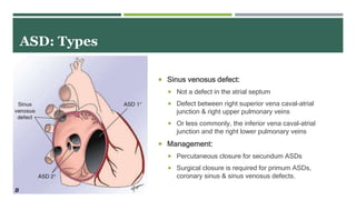 Acyanotic congenital heart disease | PPTX