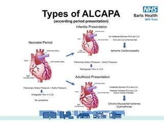 ACHD Presentation_Anomalous left coronary artery to pulmonary artery | PPTX