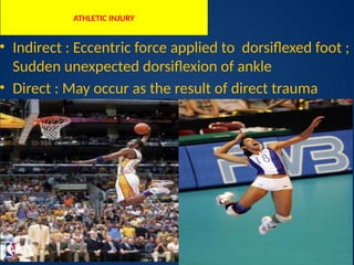 Achilles Tendon Injuries: Presentation and Management | PPTX