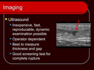Imaging
Ultrasound
Inexpensive, fast,
reproducable, dynamic
examination possible
Operator dependent
Best to measure
thickness and gap
Good screening test for
complete rupture
 