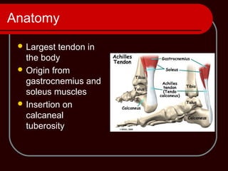 Anatomy
 Largest tendon in
the body
 Origin from
gastrocnemius and
soleus muscles
 Insertion on
calcaneal
tuberosity
 
