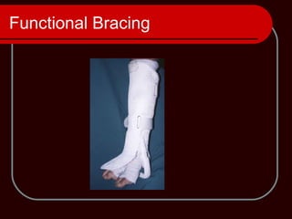 Functional Bracing
 