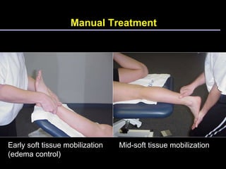 Manual Treatment Early soft tissue mobilization (edema control) Mid-soft tissue mobilization 