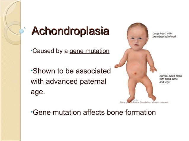 Achondroplasia gene mutation linked to paternal age | PPT