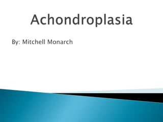 Achondroplasia By: Mitchell Monarch 