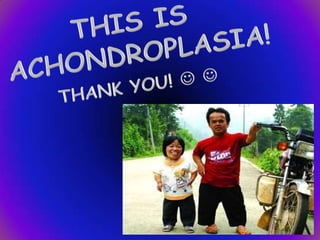 THIS ISACHONDROPLASIA!THANK YOU!  