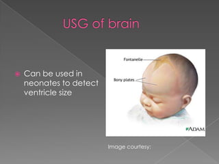 

Can be used in
neonates to detect
ventricle size

Image courtesy:

 