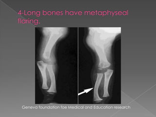 Geneva foundation foe Medical and Education research

 