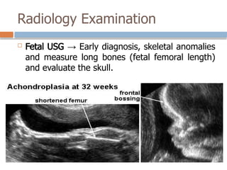 Radiology Examination
 Fetal USG → Early diagnosis, skeletal anomalies
and measure long bones (fetal femoral length)
and evaluate the skull.
 