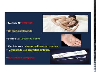 Método AC TEMPORAL
De acción prolongada
Se inserta subdérmicamente
Consiste en un sistema de liberación continua
 y gradual de una progestina sintética.
NO contiene estrógenos
 