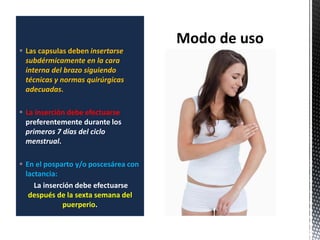  Las capsulas deben insertarse
subdérmicamente en la cara
interna del brazo siguiendo
técnicas y normas quirúrgicas
adecuadas.
 La inserción debe efectuarse
preferentemente durante los
primeros 7 días del ciclo
menstrual.
 En el posparto y/o poscesárea con
lactancia:
La inserción debe efectuarse
después de la sexta semana del
puerperio.
 