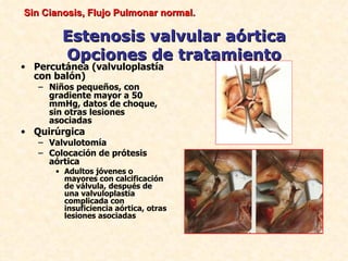 Sin Cianosis, Flujo Pulmonar normal.

        Estenosis valvular aórtica
        Opciones de tratamiento
• Percutánea (valvuloplastía
  con balón)
   – Niños pequeños, con
     gradiente mayor a 50
     mmHg, datos de choque,
     sin otras lesiones
     asociadas
• Quirúrgica
   – Valvulotomía
   – Colocación de prótesis
     aórtica
      • Adultos jóvenes o
        mayores con calcificación
        de válvula, después de
        una valvuloplastía
        complicada con
        insuficiencia aórtica, otras
        lesiones asociadas
 