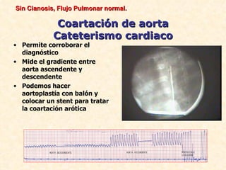 Sin Cianosis, Flujo Pulmonar normal.

             Coartación de aorta
            Cateterismo cardiaco
• Permite corroborar el
  diagnóstico
• Mide el gradiente entre
  aorta ascendente y
  descendente
• Podemos hacer
  aortoplastía con balón y
  colocar un stent para tratar
  la coartación arótica
 