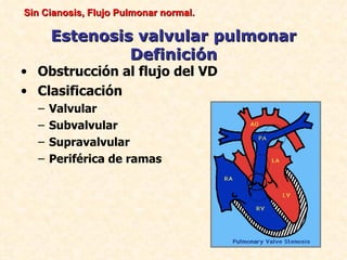 Sin Cianosis, Flujo Pulmonar normal.

       Estenosis valvular pulmonar
                Definición
• Obstrucción al flujo del VD
• Clasificación
   –   Valvular
   –   Subvalvular
   –   Supravalvular
   –   Periférica de ramas
 