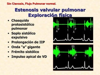 Sin Cianosis, Flujo Pulmonar normal.

     Estenosis valvular pulmonar
          Exploración física
• Chasquido
  protosistólico
  pulmonar
• Soplo sistólico
  expulsivo
• Prolongación de IIP
• Onda “a” gigante
• Frémito sistólico
• Impulso apical de VD
 