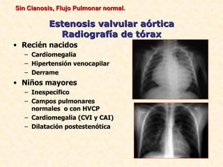 Sin Cianosis, Flujo Pulmonar normal.

          Estenosis valvular aórtica
            Radiografía de tórax
• Recién nacidos
   – Cardiomegalia
   – Hipertensión venocapilar
   – Derrame
• Niños mayores
   – Inespecífico
   – Campos pulmonares
     normales o con HVCP
   – Cardiomegalia (CVI y CAI)
   – Dilatación postestenótica
 