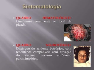  QUADRO HEMATOLÓGICO:
Limitam-se geralmente ao local da
picada.
 QUADRO NEUROTÓXICO:
Distingue do acidente botrópico, com
fenômenos compatíveis com ativação
do sistema nervoso autônomo
parassimpático.
 