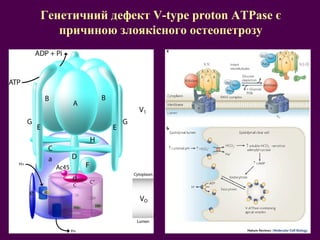 Генетичний дефект V-type proton ATPase є 
причиною злоякісного остеопетрозу 
 