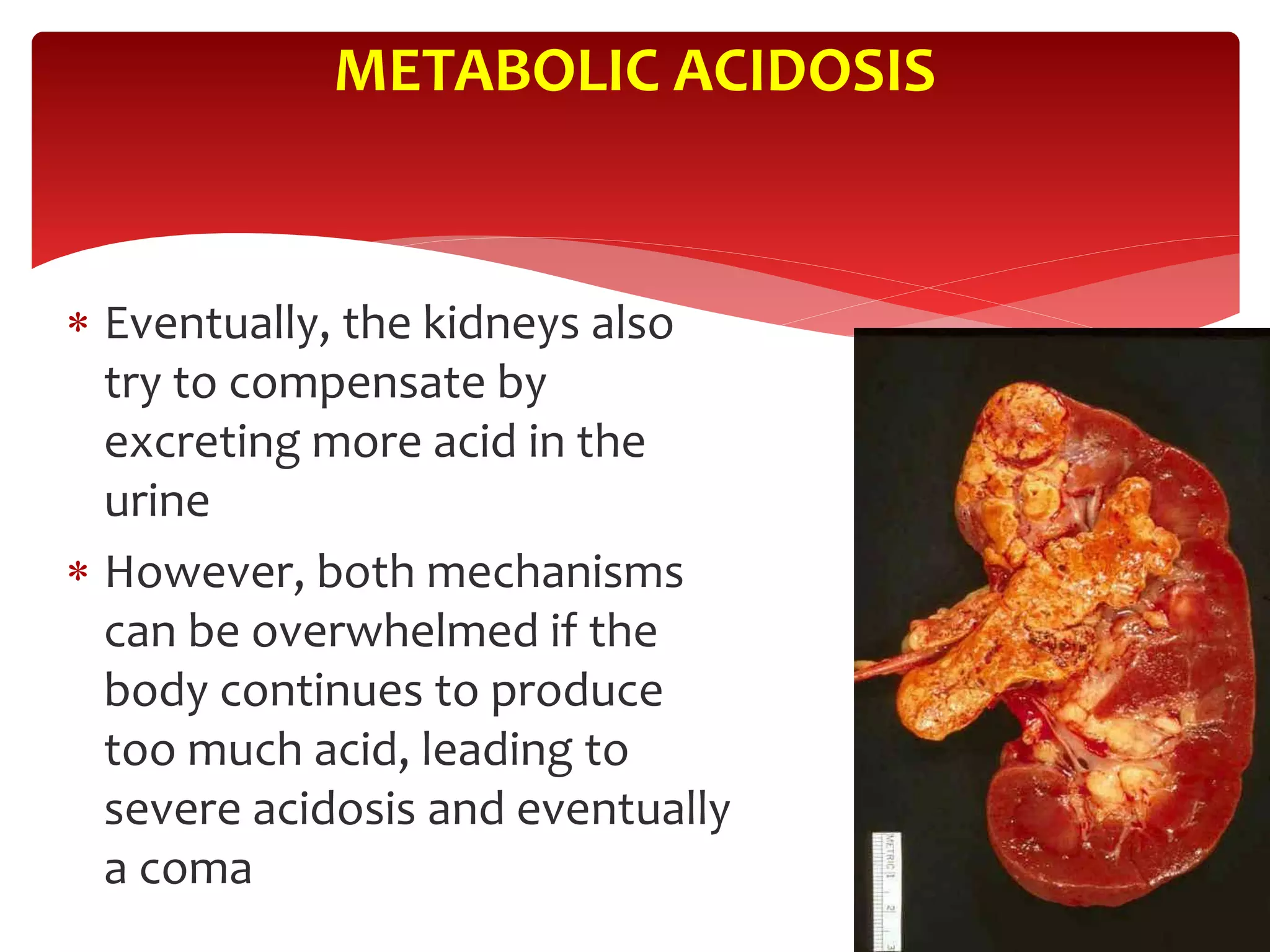  Eventually, the kidneys also
try to compensate by
excreting more acid in the
urine
 However, both mechanisms
can be overwhelmed if the
body continues to produce
too much acid, leading to
severe acidosis and eventually
a coma
METABOLIC ACIDOSIS
 