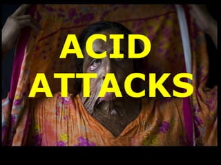 ACID
ATTACKS
 
