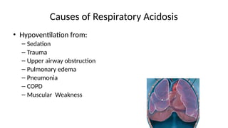 pathophysiology of Acid base balance.pptx