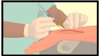 Acid base disorder and Arterial Blood Gas Analysis .pptx