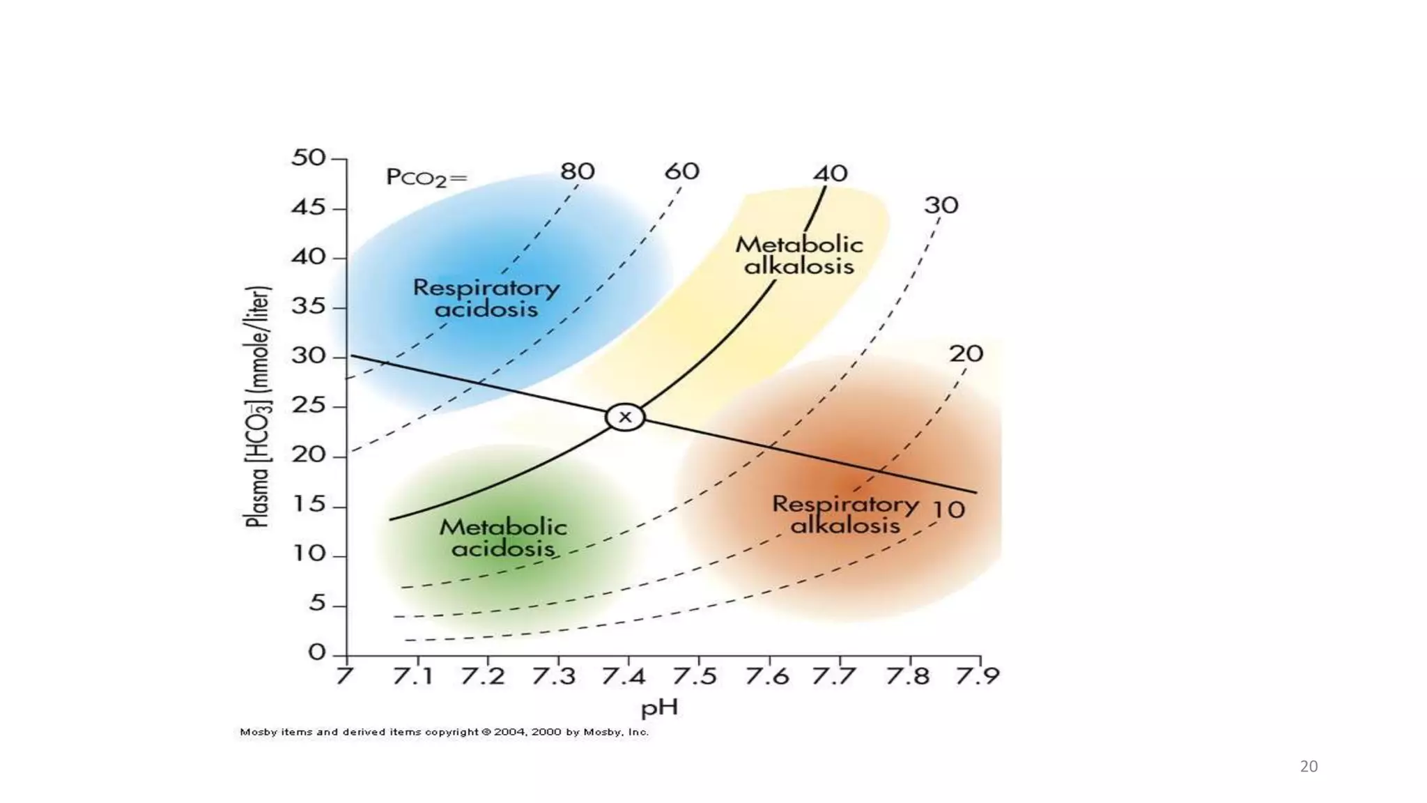 Acid Base Imbalance.pptx