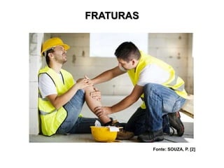FRATURAS
Fonte: SOUZA, P. [2]
 