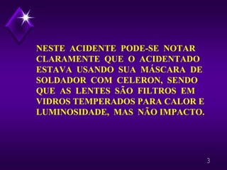 3
NESTE ACIDENTE PODE-SE NOTAR
CLARAMENTE QUE O ACIDENTADO
ESTAVA USANDO SUA MÁSCARA DE
SOLDADOR COM CELERON, SENDO
QUE AS LENTES SÃO FILTROS EM
VIDROS TEMPERADOS PARA CALOR E
LUMINOSIDADE, MAS NÃO IMPACTO.
 