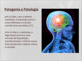 Patogenia e Patologia
pós 10 dias, com o edema
resolvido, a transição entre a
zona infartada e o tecido
normal torna-se nítida (TC)
ntre 10 dias e 3 semanas, a
fagocitose provoca uma
necrose de liquefação,
transformando o infarto numa
área amolecida e depois cística
e retraída
 