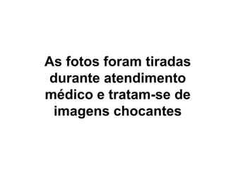 As fotos foram tiradas
durante atendimento
médico e tratam-se de
imagens chocantes
 