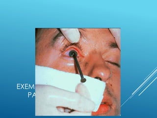 EXEMPLO DE INCAPACIDADE
PARCIAL PERMANENTE
 