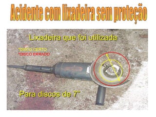 Lixadeira que foi utilizada Para discos de 7” Acidente com lixadeira sem proteção *DISCO CERTO *DISCO ERRADO 
