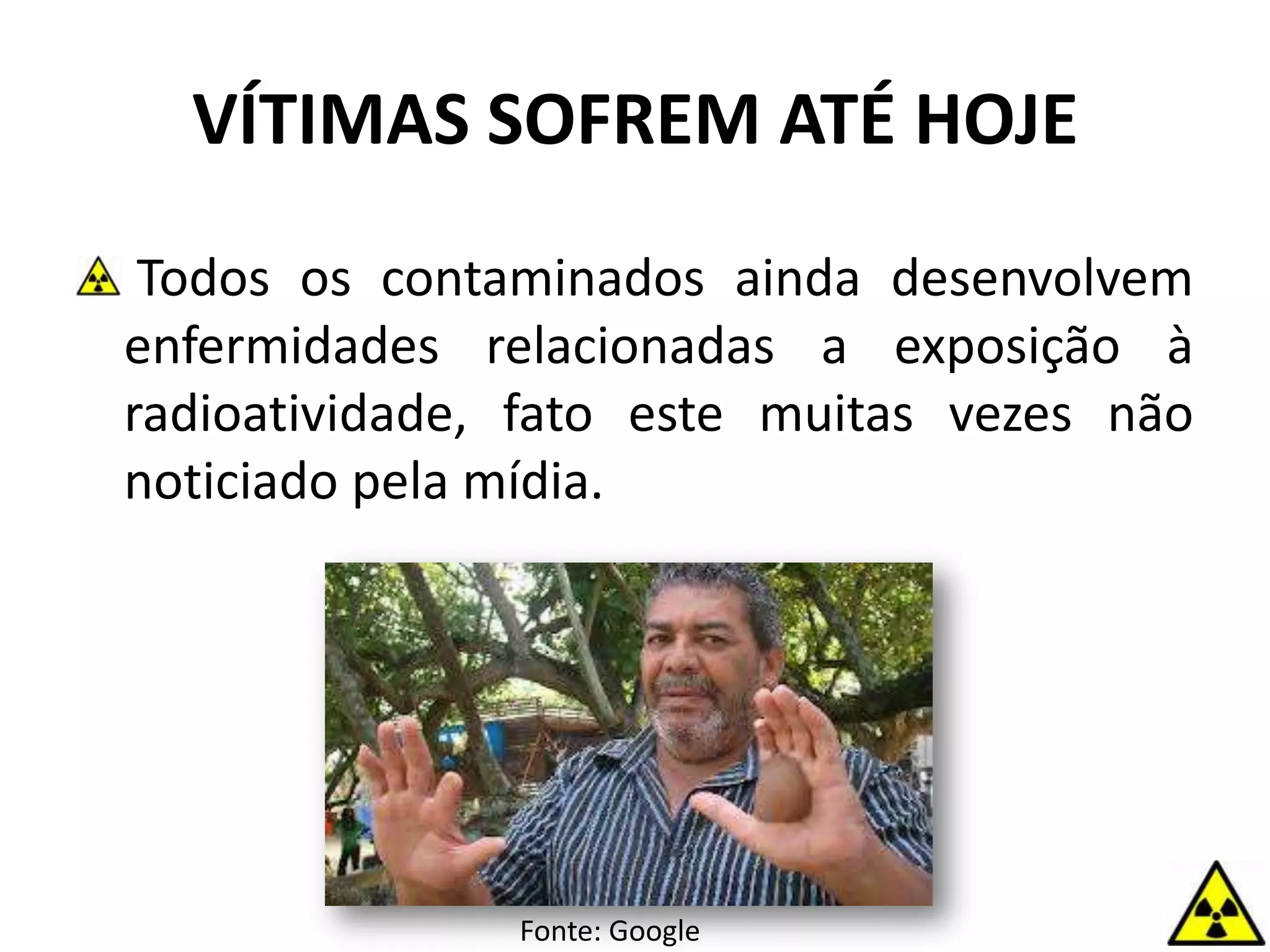 Todos os contaminados ainda desenvolvem
enfermidades relacionadas a exposição à
radioatividade, fato este muitas vezes não
noticiado pela mídia.
VÍTIMAS SOFREM ATÉ HOJE
Fonte: Google
 