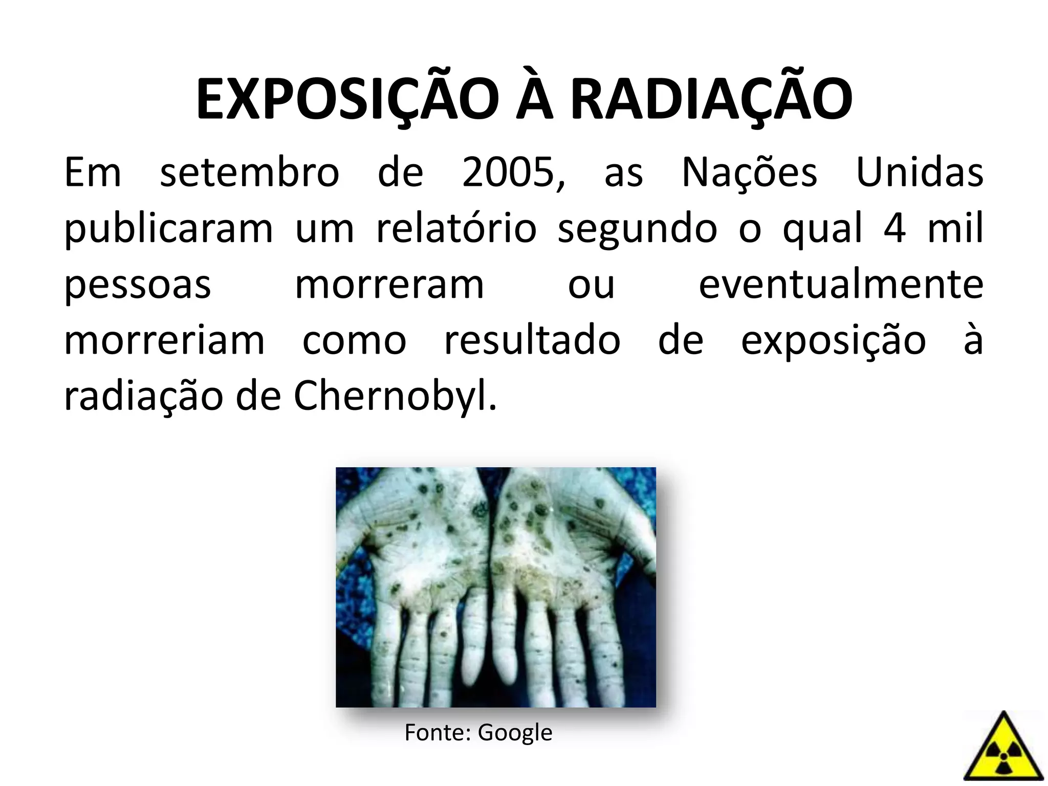 EXPOSIÇÃO À RADIAÇÃO
Em setembro de 2005, as Nações Unidas
publicaram um relatório segundo o qual 4 mil
pessoas morreram ou eventualmente
morreriam como resultado de exposição à
radiação de Chernobyl.
Fonte: Google
 