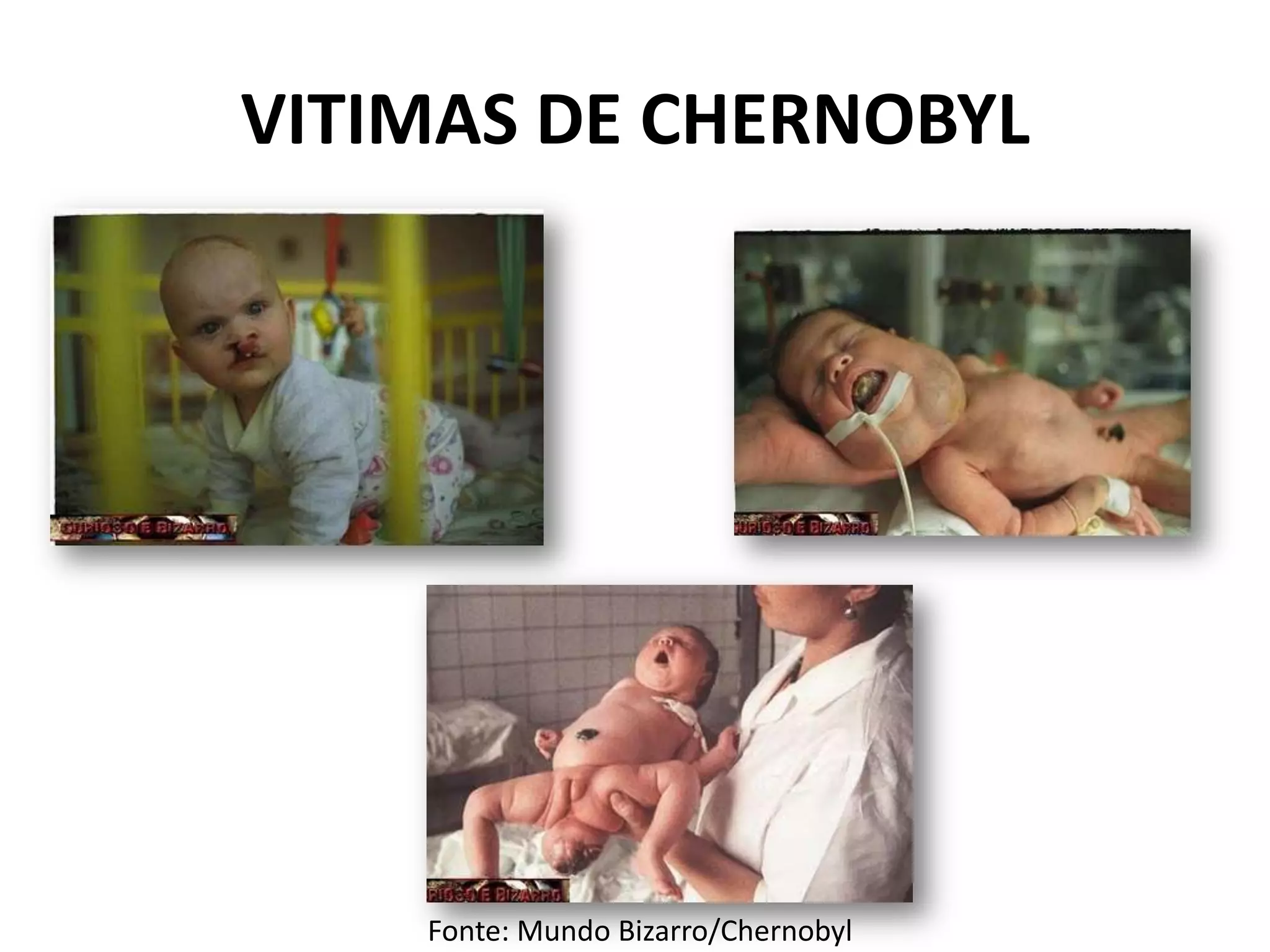 VITIMAS DE CHERNOBYL
Fonte: Mundo Bizarro/Chernobyl
 