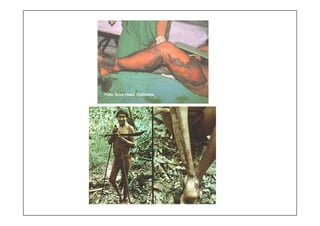 Foto: Silva Haad, Colômbia
 