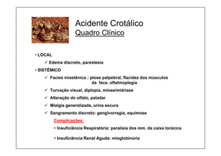 Acidente Crotálico
Quadro Clínico
• LOCAL
9 Edema discreto, parestesia
• SISTÊMICO
9 Facies miastênica : ptose palpebral, flacidez dos músculos
da face, oftalmoplegia
9 Turvação visual, diplopia, miose/midríase
9 Alteração do olfato, paladar
9 Mialgia generalizada, urina escura
9 Sangramento discreto: gengivorragia, equimose
Complicações:
ƒ Insuficiência Respiratória: paralisia dos mm. da caixa torácica
ƒ Insuficiência Renal Aguda: mioglobinúria
 