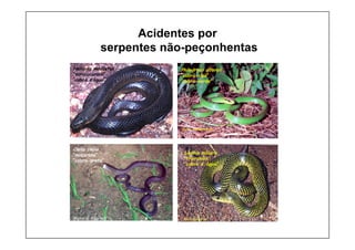 Acidentes por
serpentes não-peçonhentas
Helicops modestus
“surucucurana”
“cobra d’água”
Foto: G.Puorto
Philodryas olfersii
“cobra-cipó”
“cobra-verde”
Foto: A Melgarejo
Liophis miliaris
“trairabóia”
“cobra d’ água”
Foto: G.Puorto
(Foto: G. Puorto)
Clelia clelia
“muçurana”
“cobra-preta”
 