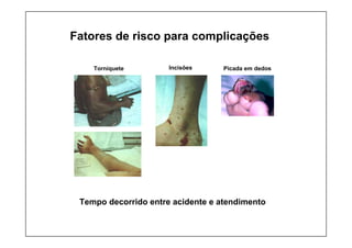 Fatores de risco para complicações
Tempo decorrido entre acidente e atendimento
Torniquete Incisões Picada em dedos
 