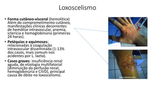 Loxoscelismo
• Forma cutâneo-visceral (hemolítica)
Além do comprometimento cutâneo,
manifestações clínicas decorrentes
de hemólise intravascular, anemia,
icterícia e hemoglobinúria (primeiras
24 horas).
• Petéquias e equimoses:
relacionadas à coagulação
intravascular disseminada (1-13%
dos casos, mais comum nos
acidentes por L. laeta).
• Casos graves: insuficiência renal
aguda, de etiologia multifatorial
(diminuição da perfusão renal,
hemoglobinúria e CIVD), principal
causa de óbito no loxoscelismo.
 
