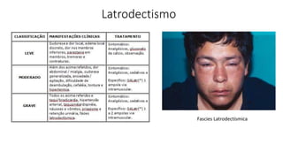 Latrodectismo
Fascies Latrodectísmica
 