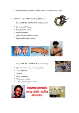  Hábitos diurnos (escondem-se durante a noite e saem de dia para caçar).




3 ACIDENTE COM SERPENTES PEÇONHENTAS

     3.1 ACIDENTES BOTRÓPICOS (JARARACAS)

   Dor no Local da Picada;
   Pode apresentar edema;
   Tem sangramentos;
   Pode apresentar náuseas e êmese e
   Sudorese e hipotensão arterial.




     3.2 ACIDENTES CROTÁLICOS (CASCAVÉIS)

   Ação Neurotóxica, miotóxica e coagulante;
   Visão duplicada;
   Náuseas;
   Dores musculares;
   Urina de cor escura e
   A dor é pequena e pouco intensa.
 