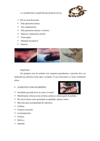 3.3 ACIDENTES LAQUÉTICOS (SURUCUCUS)


    Dor no local da picada;
    Pode apresentar edema;
    Tem sangramentos;
    Pode apresentar náuseas e vômitos;
    Sudorese e hipotensão arterial;
    Visão dupla;
    Dilatação da pupila E
    Diarreia.




          Importante:
          Em qualquer caso de acidente com serpentes peçonhentas, o paciente deve ser
medicado nas primeiras horas após o acidente. O soro antiveneno é o único tratamento
eficaz.


4 ACIDENTES COM ESCORPIÕES

 Ansiedade que pode levar ao coma e à morte;
 Manifestações clínicas como arritmia cardíaca e edema agudo de pulmão;
 Dor local intensa como queimação ou agulhada, edema e rubor;
 Mal-estar geral acompanhado de sudoreses;
 Cefaleia;
 Fraqueza muscular;
 Lacrimejamento;
 Tontura;
 Delírio e
 Agitação.
 