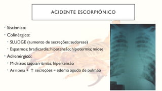 ACIDENTE ESCORPIÔNICO
• Sistêmico:
• Colinérgico:
• SLUDGE (aumento de secreções; sudorese)
• Espasmos; bradicardia; hipotensão; hipotermia; miose
• Adrenérgico:
• Midríase; taquiarritmias; hipertensão
• Arritmia + ↑ secreções = edema agudo de pulmão
 
