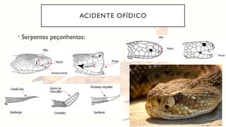 ACIDENTE OFÍDICO
• Serpentes peçonhentas:
 